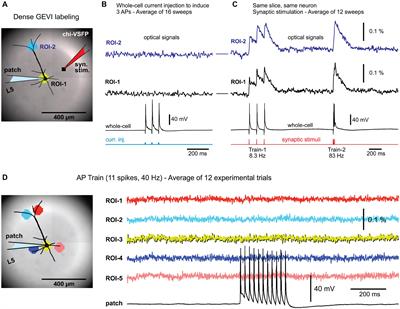 Studying Synaptically Evoked Cortical Responses ex vivo With Combination of a Single Neuron Recording (Whole-Cell) and Population Voltage Imaging (Genetically Encoded Voltage Indicator)